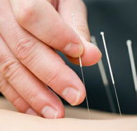 Kingscliff Acupuncture  Massage - Adwords Guide