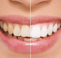 Newcastle Dental Care - Adwords Guide