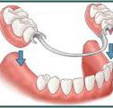 Denture Success - Adwords Guide