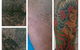 Laserpro Tattoo Removal - thumb 0