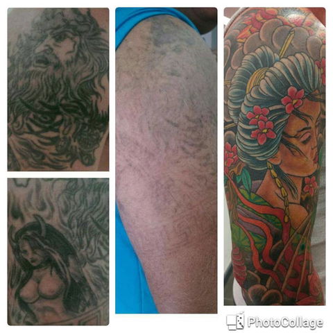 Laserpro Tattoo Removal - Adwords Guide 0