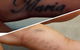 Laserpro Tattoo Removal - thumb 2