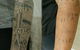 Laserpro Tattoo Removal - thumb 3
