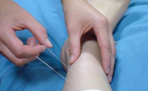 NT Physiotherapy Clinic - Adwords Guide 4