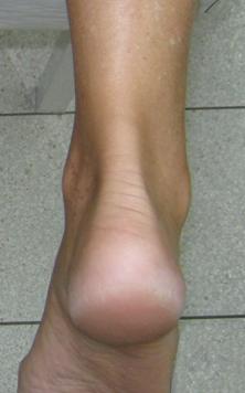 James Pascoe Podiatry - Adwords Guide 2