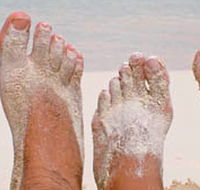 Innovation Podiatry - Adwords Guide